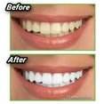 Miracle Teeth Whitener - ZEEKO.AE